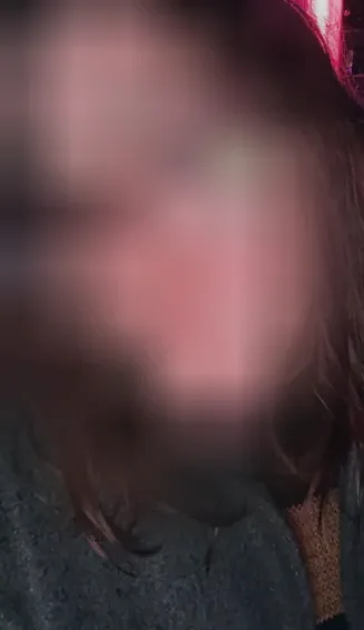 Milla, 24